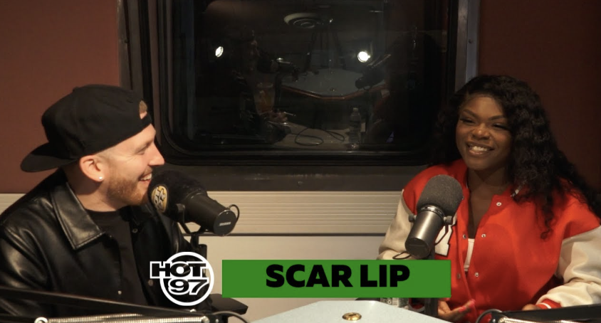 Scar Lip On Upbringing, Shaq, Swizz Beatz + Support From Artists!